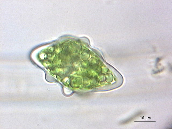 Actinotaenium phymatosporum, zygospore