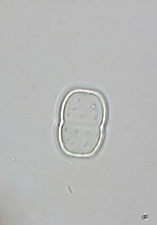 Actinotaenium subtile, empty cell