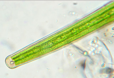 Closterium angustatum, detail of cell end