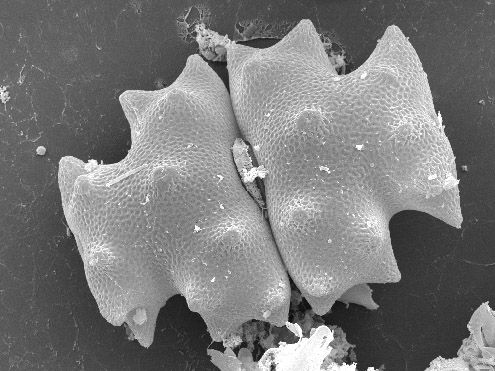 Euastrum pectinatum, SEM-afbeelding