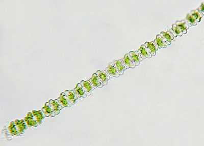 Extra long filament of Sp. pulchellum