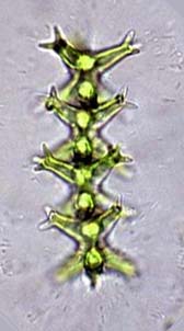 chain of Staurastrum brachiatum