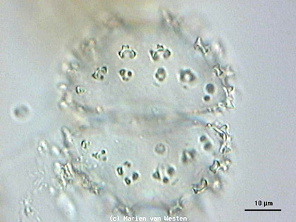 Staurastrum spongiosum, lege cel in achter-aanzicht