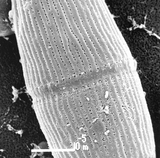 Actinotaenium silvae-nigrae SEM-foto detail