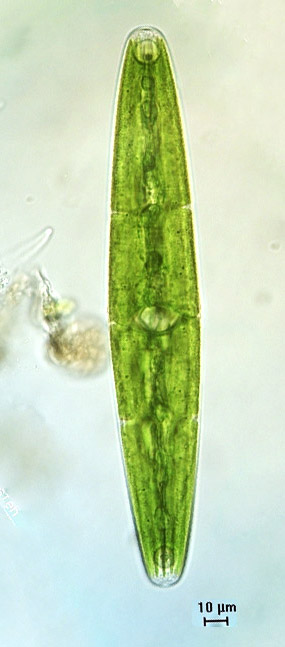 Closterium closterioides, partitioned chloroplasts