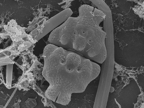 SEM-foto van Euastrum ampullaceum