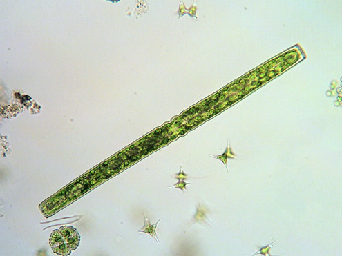 another cell of Pleurotaenium ehrenbergii