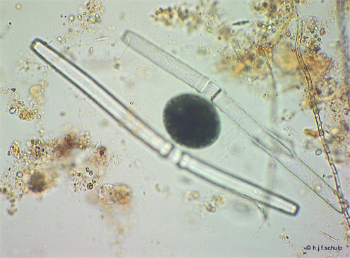 zygospore van Pleurotaenium ehrenbergii