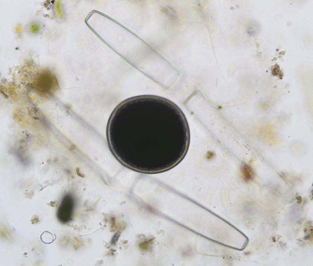 Pleurotaenium trabecula, zygospore