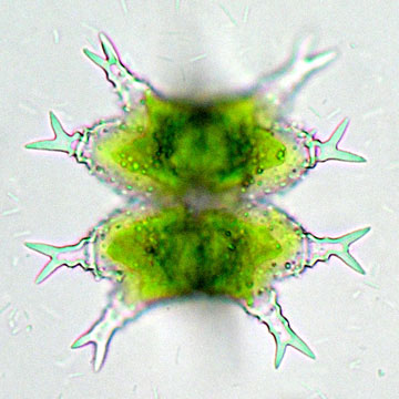 Een andere cel van Staurastrum furcigerum