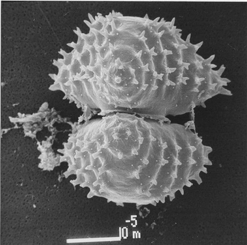 Staurastrum scabrum SEM-foto, vooraanzicht