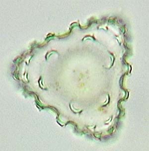 Staurastrum spongiosum, lege semicel in top-aanzicht