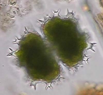 Staurastrum spongiosum met gestiekelde in plaats van uitgerande uitsteeksels
