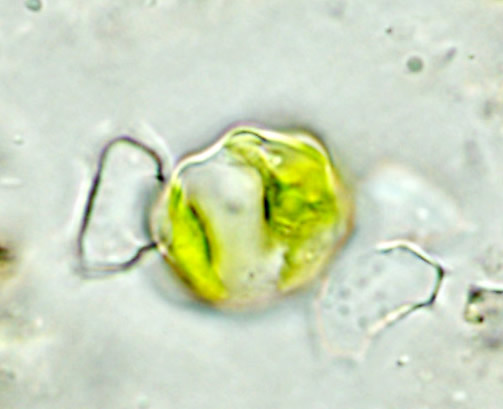 Xanthidium bifidum, zygospore