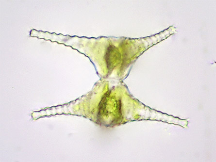 Staurastrum cingulum