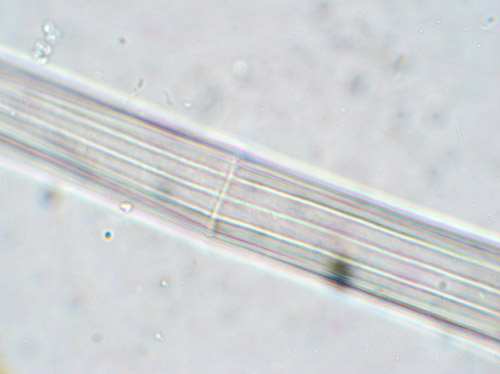 Closterium angustatum, detail of midregion of a dead, empty cell