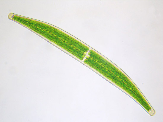 Closterium striolatum