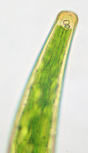 Closterium striolatum, detail of cell end