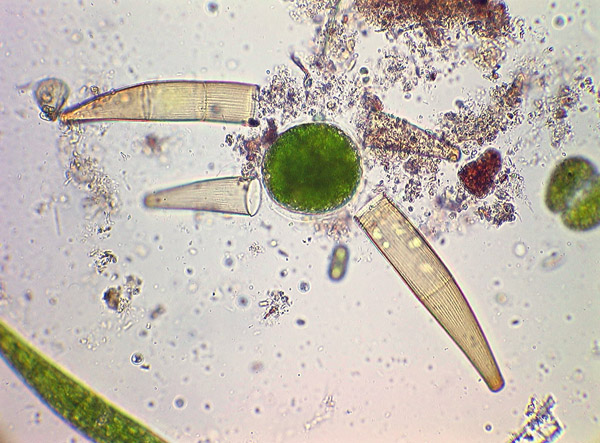 Closterium striolatum, zygospore