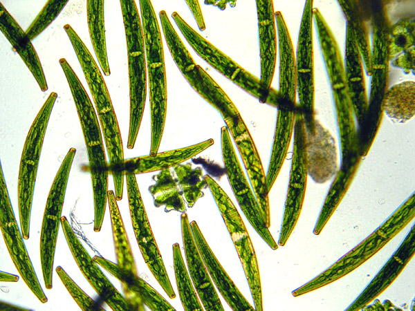 Closterium striolatum, algal bloom