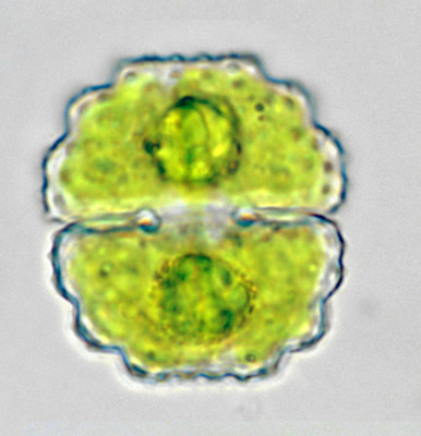 Cosmarium subprotumidum, another cell