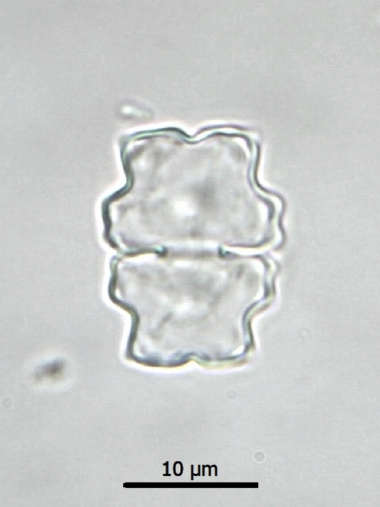 Euastrum subalpinum