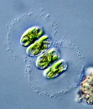 Two cells of Spondylosium ellipticum