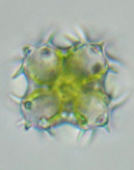 Staurastrum hystrix, quadriradiate in apical view