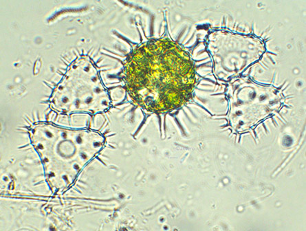 Staurastrum teliferum, zygospore