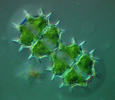 Xanthidium cristatum , mucilaginous extracellular envelope