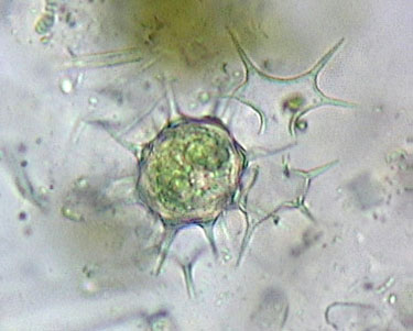 zygospore of Xanthidium octocorne