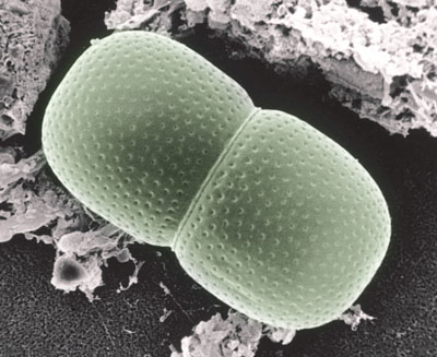 SEM image of Actinotaenium cucurbita