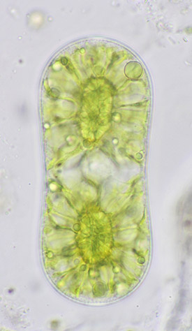 Actinotaenium diplosporum forma maius showing more details of chloroplast