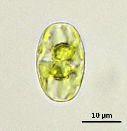 Actinotaenium mooreanum showing chloroplast