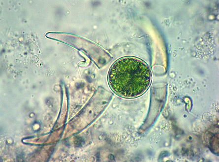 Closterium cynthia, zygospore