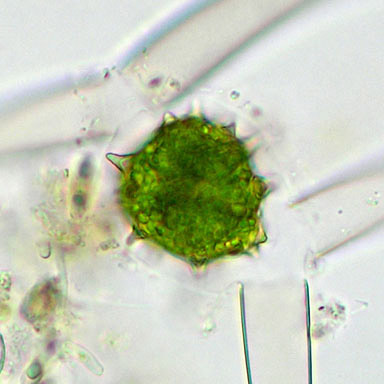 Closterium calosporum, zygospore