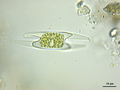 Closterium cornu, zygospore