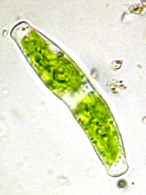 Closterium pusillum var. laticeps