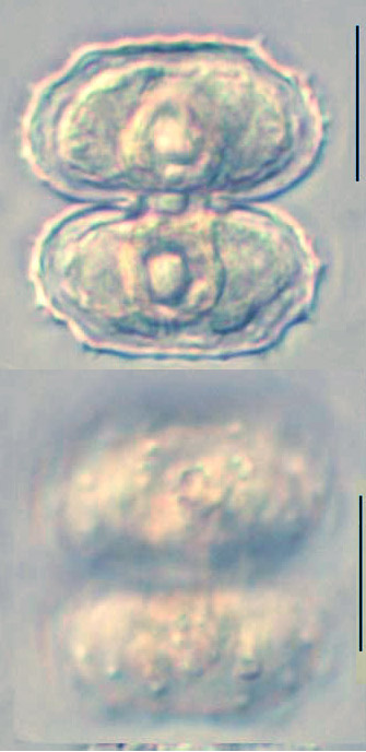 Cosmarium denboeri, empty cell