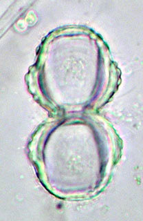 Cosmarium formosulum, empty cell in lateral view