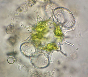 Cosmarium punctulatum zygospore