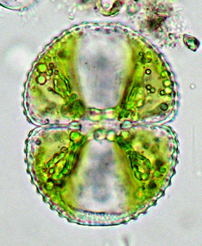 Cell of Cosmarium botrytis showing pattern of granules