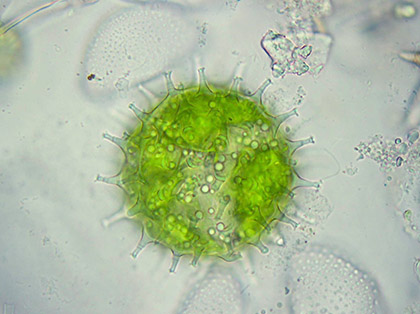 Zygospore of Cosmarium botrytis in more detail.