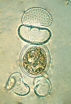 Cosmarium reniforme zygospore