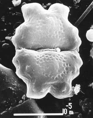 SEM image of Euastrum binale