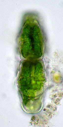 Euastrum crassum in lateral view