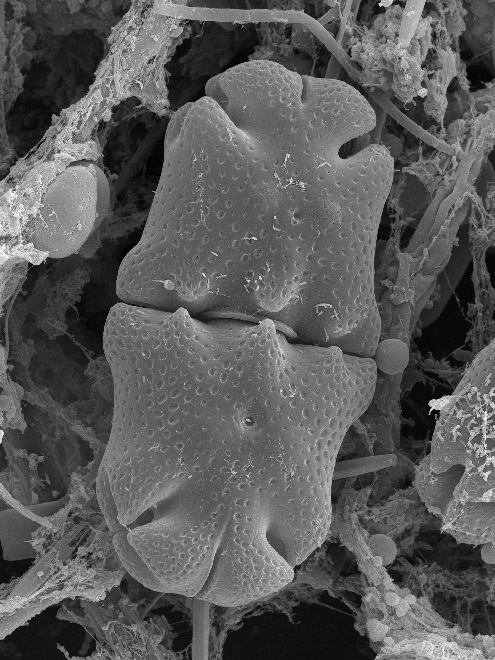 Euastrum crassum, SEM image