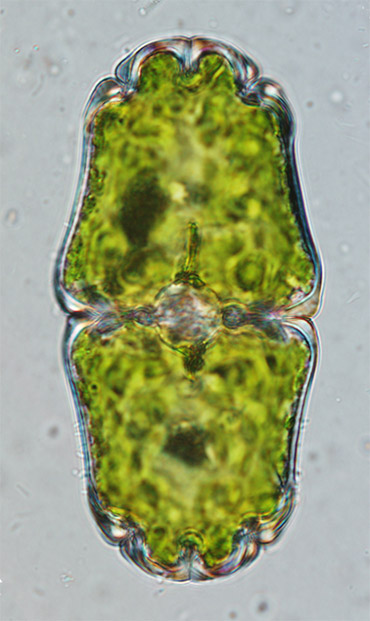 Euastrum crassum var. microcephalum