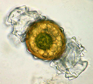 Euastrum pectinatum, zygospore