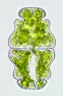 Euastrum ventricosum